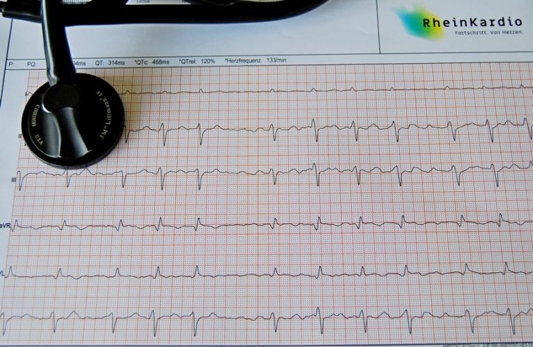 Kardioversion Wie geht es danach weiter? RheinKardio